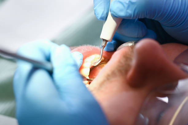 Best Emergency Treatment for Toothache in Fairfax, OK