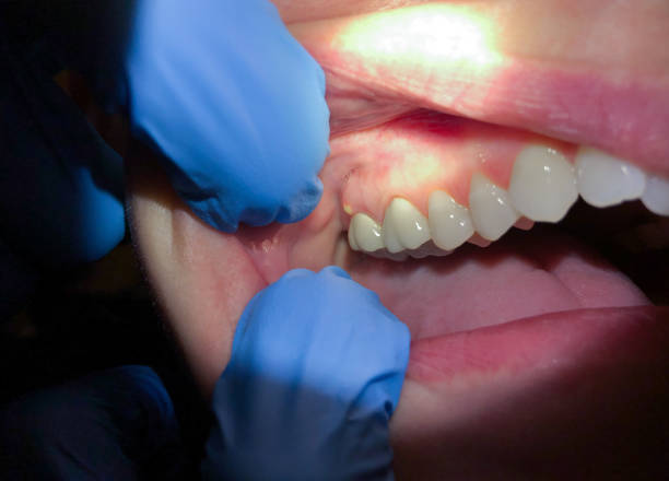 Best Same-Day Emergency Dentist in Fairfax, OK
